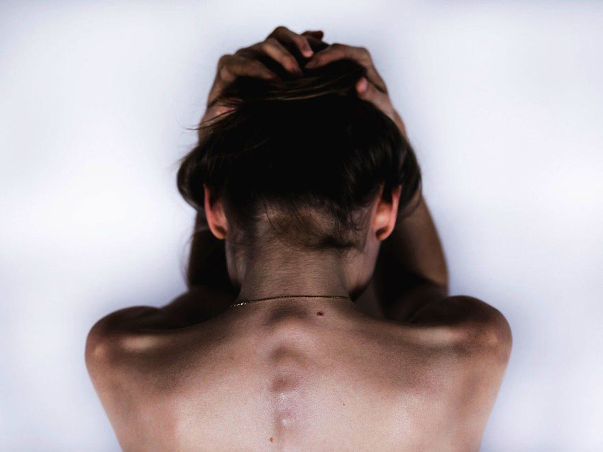 Migrena z aurą – Sprawdź jak ją ujarzmiłam
